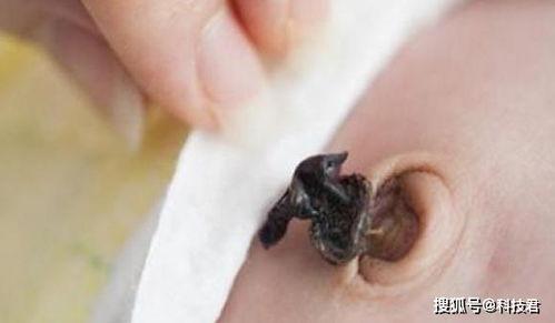 脐带护理视频,新手爸妈必看视频教程